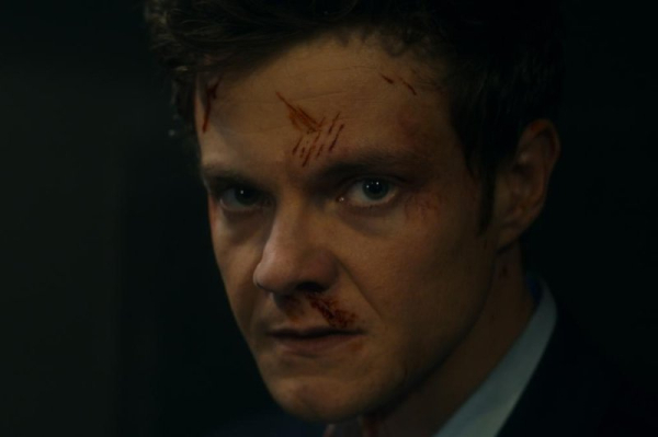 Movie review: 'Novocaine' is fun in fits and starts